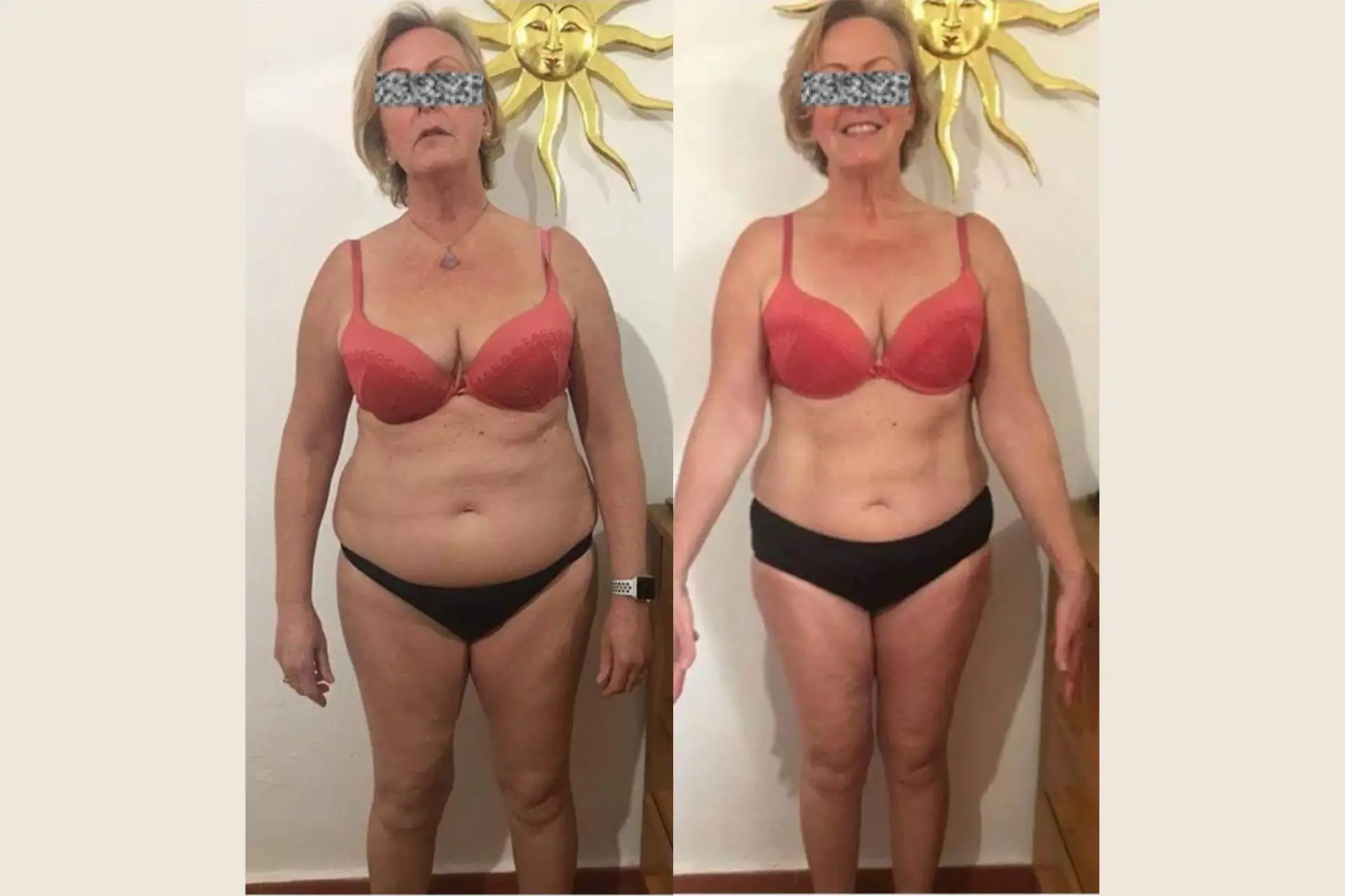 Skinetica before and after
