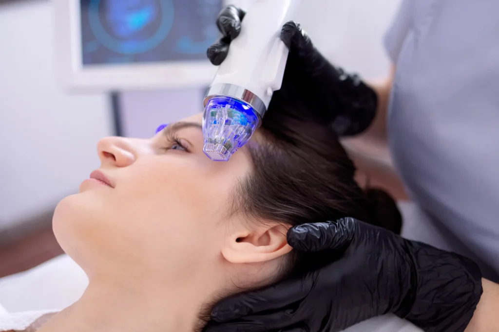 microneedling RF (1)