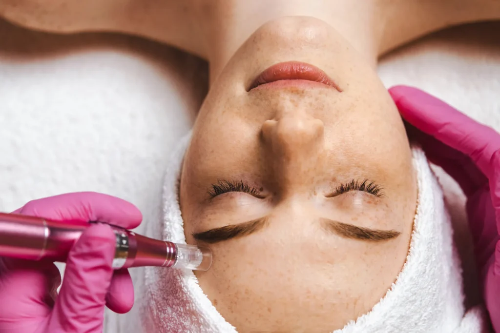 microneedling pen